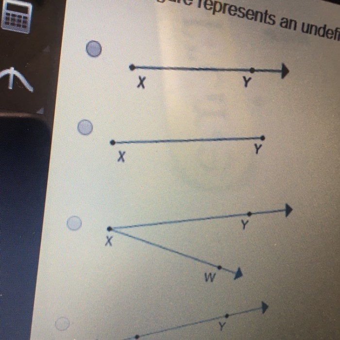 Undefined term figure represents which