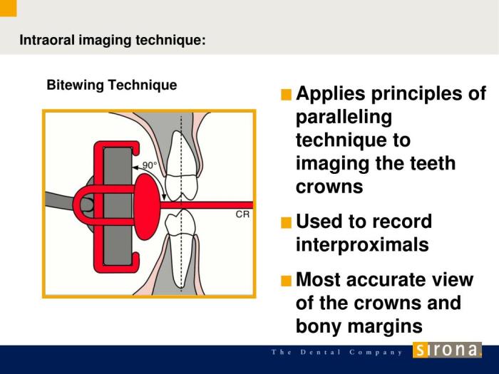 Basic principles of the bitewing technique include the: